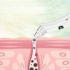 Skincleans ClearVac